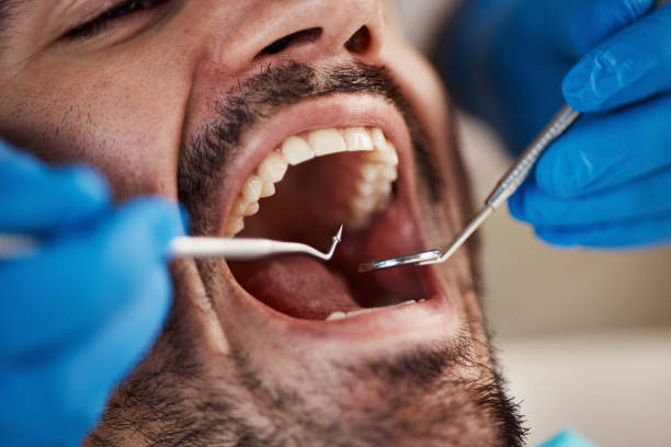 Best Urgent Dental Care for Toothaches in Leawood, KS